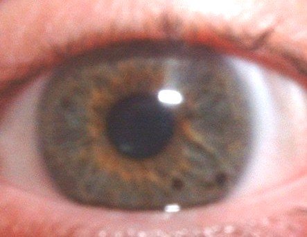 eye1a.jpg