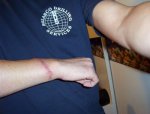 scar2.jpg