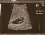 ultrasound1.jpg