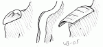 Split, shoulder variants.gif