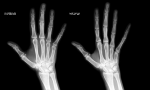 Drow Hand.png