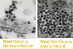 westnile.jpg