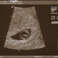 ultrasound1.jpg