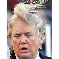 donald-trump-hair-photos-mystery-transplant-combover_2014-09-14_21-59-27-573x430.jpg