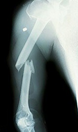 ortho.jpg