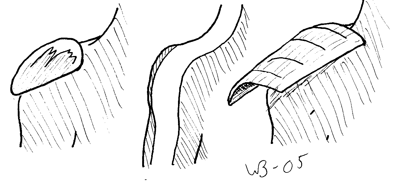 Split, shoulder variants.gif
