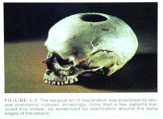 Trepanation-jpeg.jpg