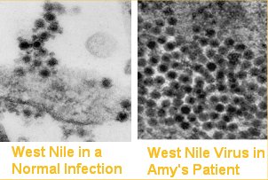 westnile.jpg